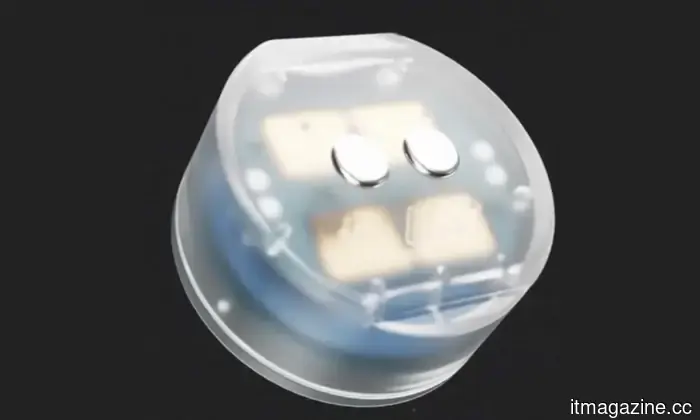 This small brain implant has the potential to alleviate depression from home.