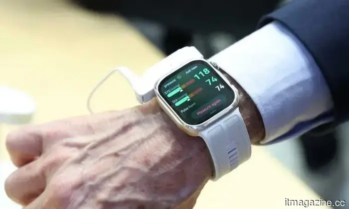 Un orologio intelligente che misura il livello reale della pressione sanguigna è dietro l'angolo e non sembra ridicolo.