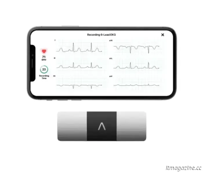 I migliori gadget per la salute e il fitness per iPhone