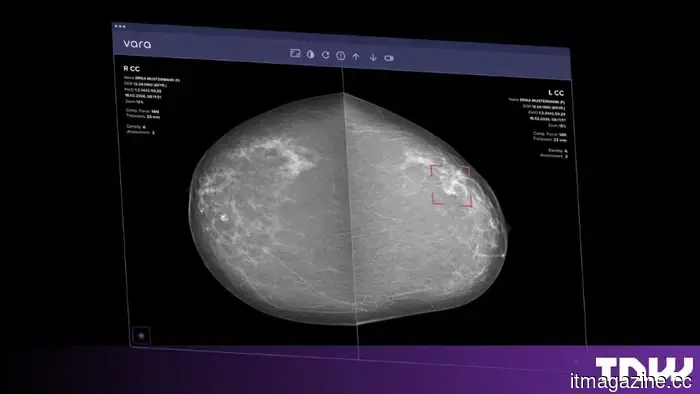 Vara achieves the world's first CE mark for AI technology that independently analyzes mammograms.